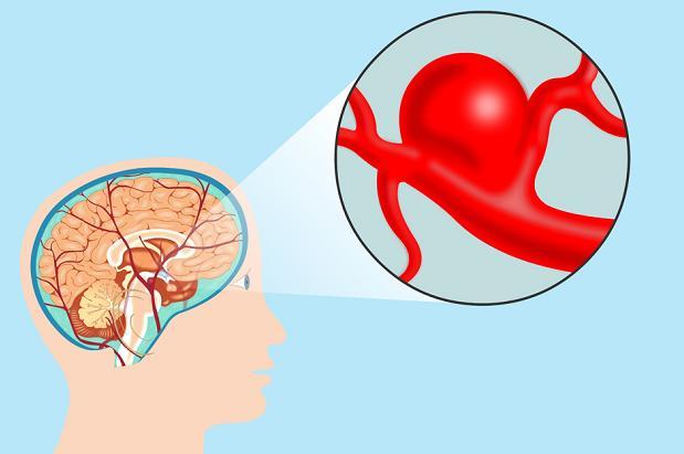 “新血压标准”或已公布，不再是120~80mmHg，早了解不吃亏！掌握最新标准