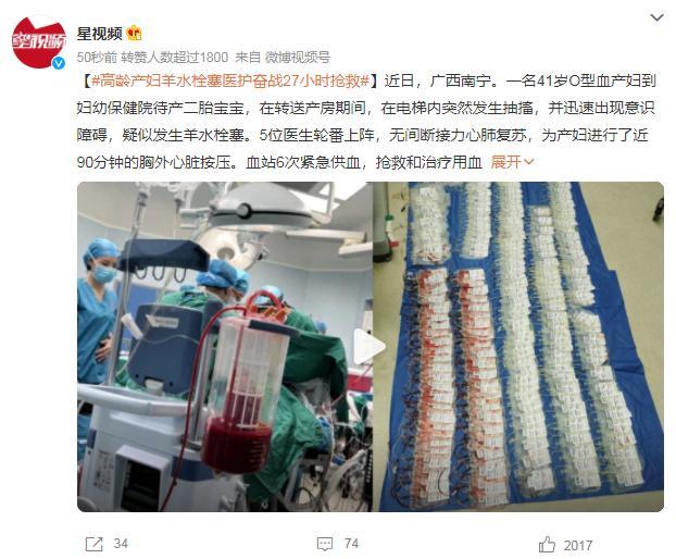 产妇羊水栓塞医护抢救 最终成功地将产妇从死亡线上拉了回来