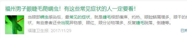 13歲男孩眼癢取出86條螨蟲,，醫(yī)生提醒：吃甜食熬夜眼睛或長螨蟲 不良習(xí)慣助長螨蟲滋生