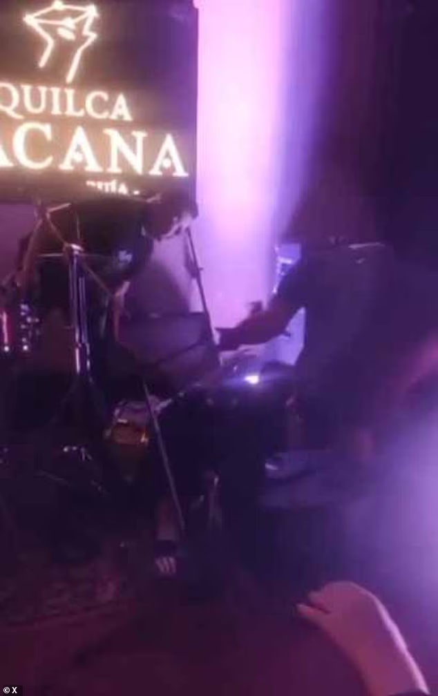 秘鲁歌手表演时被麦克风电击 意外电击致颈部烧伤