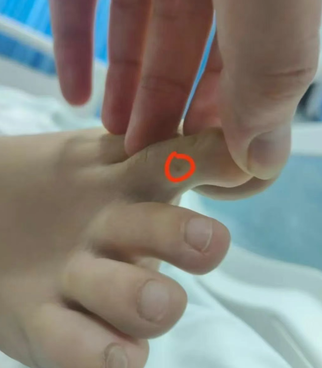 毒蛇还是毒虫咬伤？有无延误治疗？三亚市卫健委已介入调查女游客散步被咬伤身亡事件