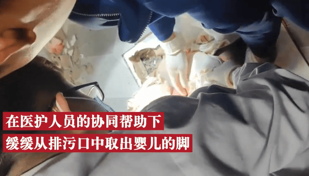 临产孕妇上厕所时突然生产,新生儿脚被卡在蹲便器中了