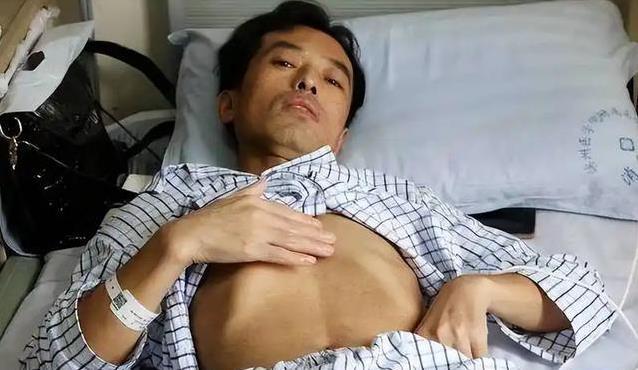 身上红痣猛增有隐患？医生揭秘真相，3点建议别忽视