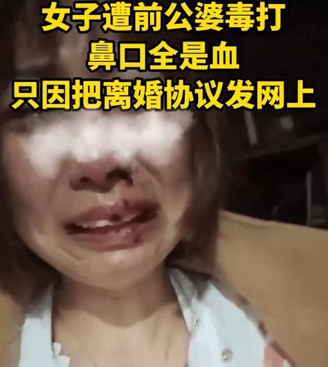 女子把离婚协议发网上遭前公婆殴打 报警回执互殴