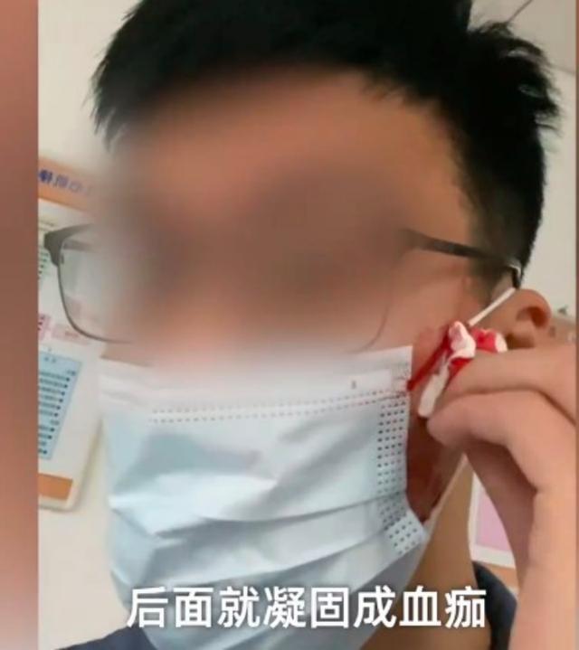 男生挤痘后流血近一小时 无论痘痘处于哪个阶段，都不建议大家自行挤压