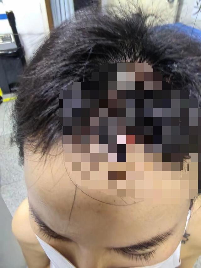 女子称被丈夫多次家暴导致肠破裂 公公：这是家事，儿子很好，身在福中不知福