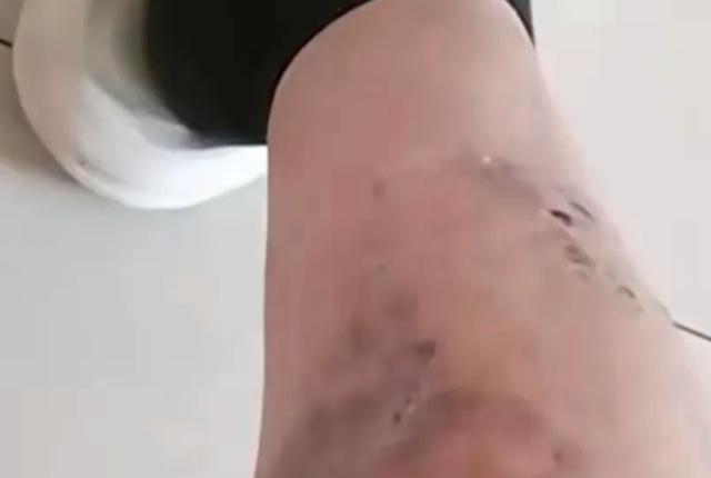 男子追债不成反被朋友卖到缅北 死里逃生辗转回国！