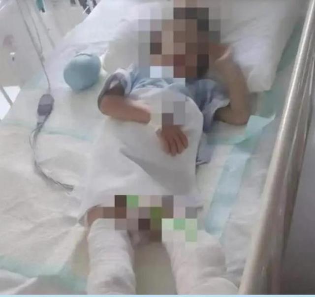 男童被虐致截肢案后续开庭 父亲：孩子不愿提母亲