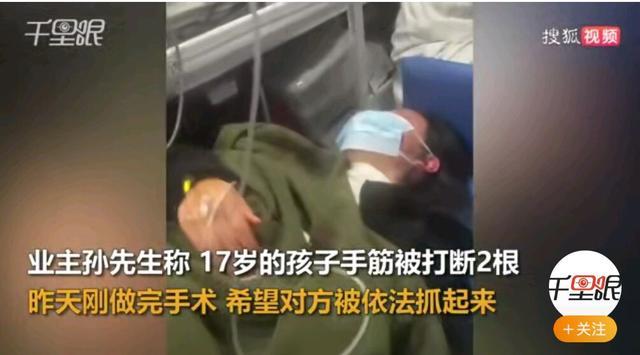 男子称四人醉酒上门收物业费发生争执,孩子手筋被打断
