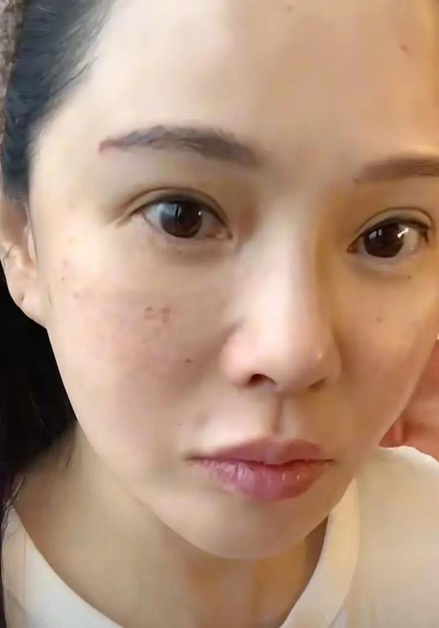 56岁伊能静晒韩国医美照 感叹：太痛了