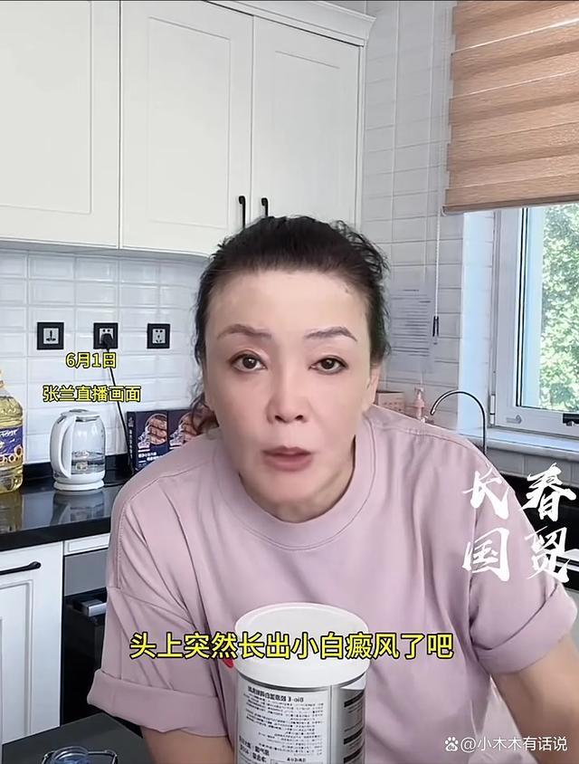 张兰承认患上白癜风 家庭添喜难掩病情忧虑