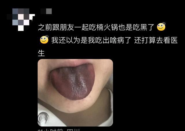 网红火锅店吃完舌头变黑 商家回应 铁锅反应惹争议