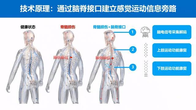 复旦团队脑脊接口研究获突破