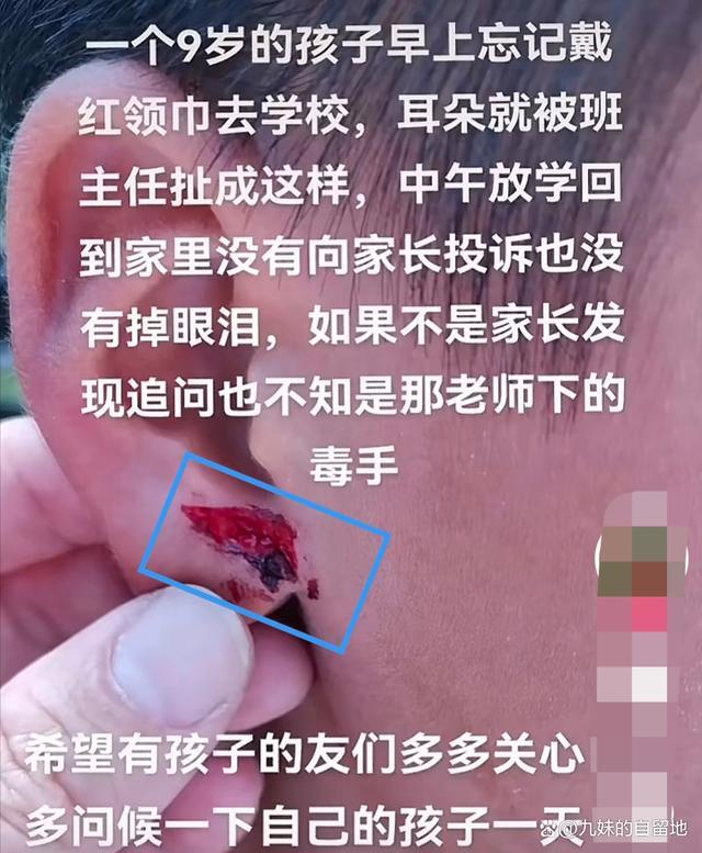 男孩没戴红领巾 老师拧其耳朵致流血