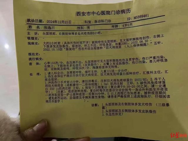 4岁男童遭恶犬袭击仍在ICU昏迷