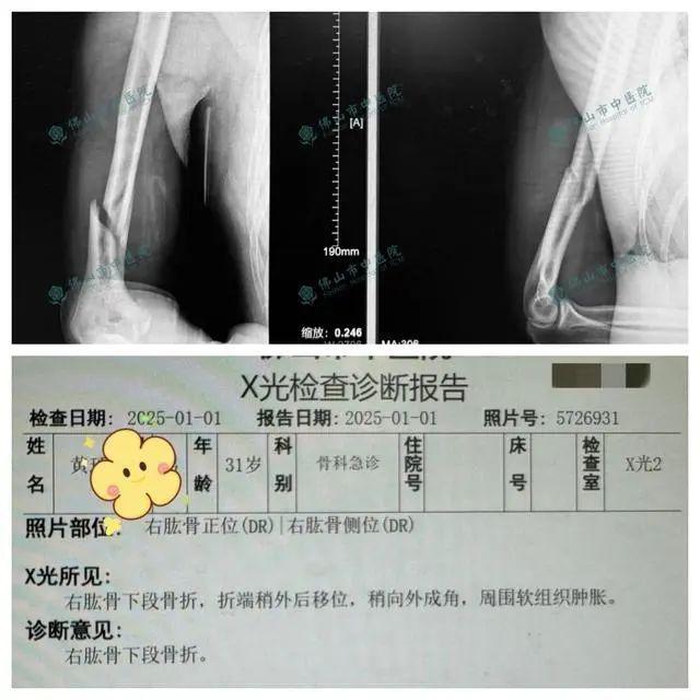 小伙与机器人扳手腕当场骨折 游乐设施隐患警示