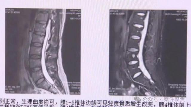 女子在餐廳門口摔倒起訴商家 索賠被駁回