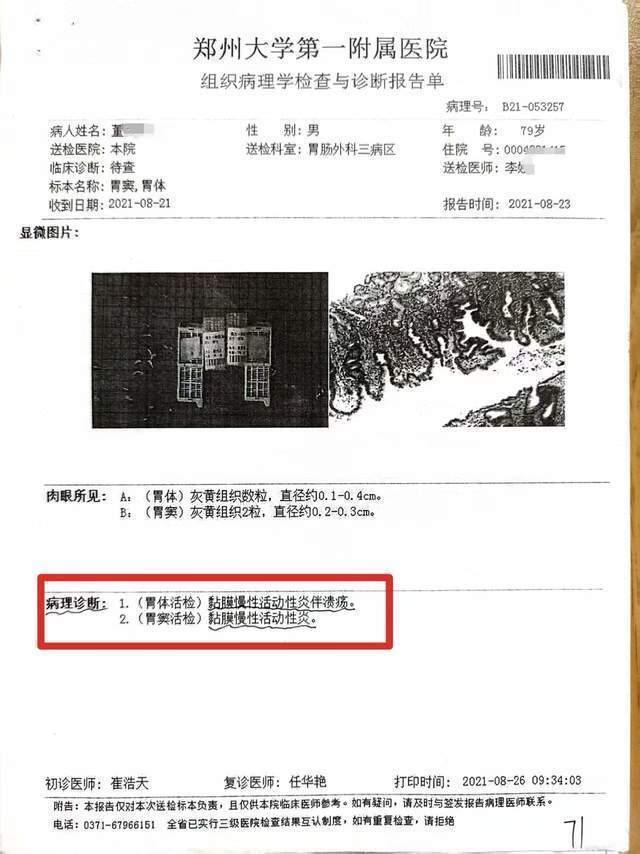 八旬老人诊断胃炎被以胃癌切全胃 医院负主责