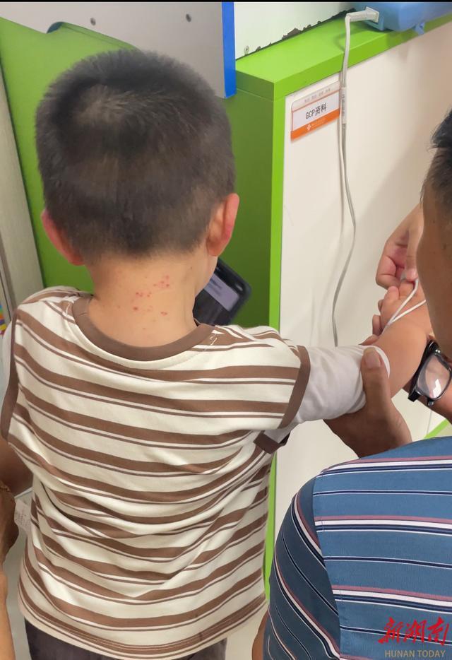 雙胞胎感染手足口病同時入院 家庭內(nèi)接力式發(fā)病需警惕