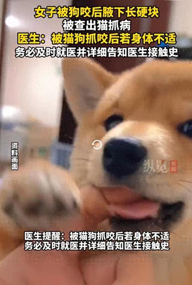 女子被狗咬后確診貓抓病