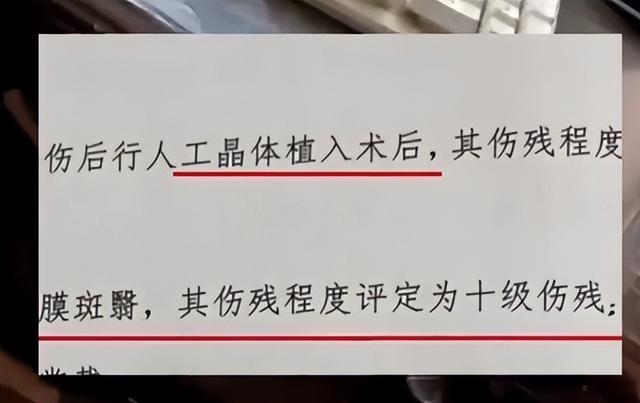 男孩被戳伤左眼赤诚涂猪油消肿致感染 需作念屡次手术