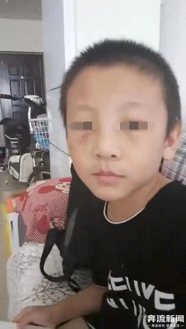 14岁少年遭生父继母长期虐待离世