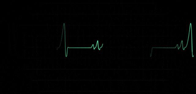 猝死前1小时身体会发出哪些预警 警惕这些信号！