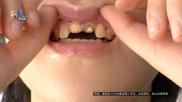 女生称就餐后遭多人殴打致门牙断裂 火锅店冲突升级
