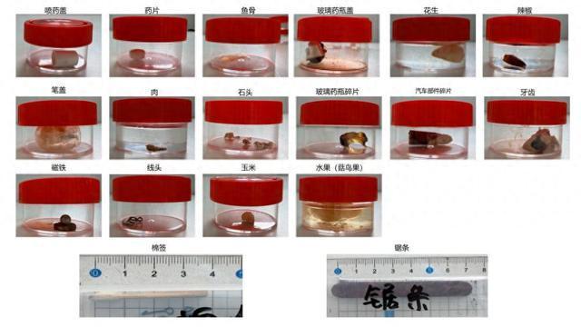 久咳不愈可能是气道里藏着“异物”