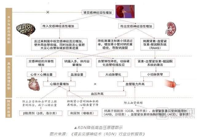 两款重磅产品同天获批，RDN赛道国产崛起！