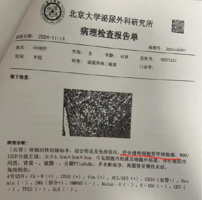 體檢10年查出癌女子追責(zé)愛康 體檢機(jī)構(gòu)回應(yīng)質(zhì)疑