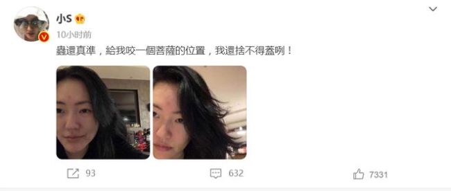 小S被虫子咬到额头自侃是菩萨 网友：更像二郎神