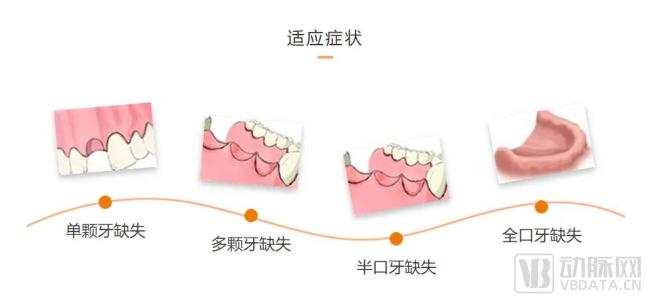 种植牙解决牙齿缺失问题  图片来源：泰康拜博口腔医院官网