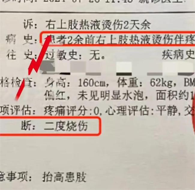 在达美乐被烫致二度烧伤，顾客索赔5000元惹争议！官方号：酱汁溅到，是最轻级