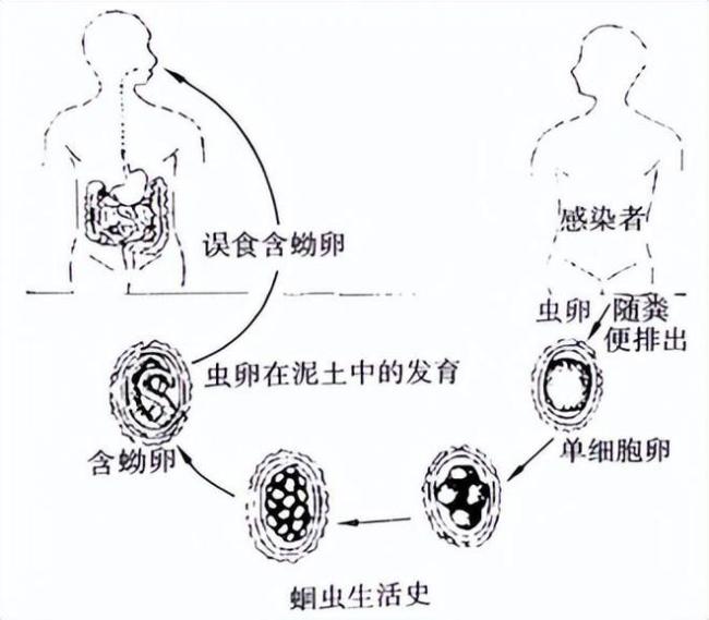 几十年前，人人肚子里几乎都有蛔虫，为何现在很少听说过了？