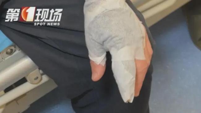      被海鲜刺伤别大意！感染创伤弧菌能要命