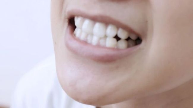 容易导致牙龈萎缩的4大原因，及时预防