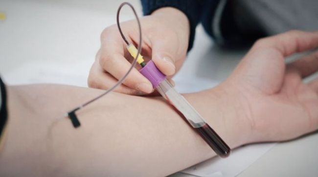 千万别慌！体检报告上这些“异常”，原来是虚惊一场