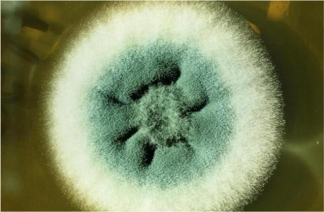 春节后，务必要小心一种霉菌，该霉菌会攻击人的脑肝肾心