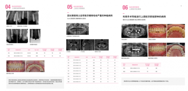 DIO种植体型号怎么选？亲水与非亲水种植体的区别与参考