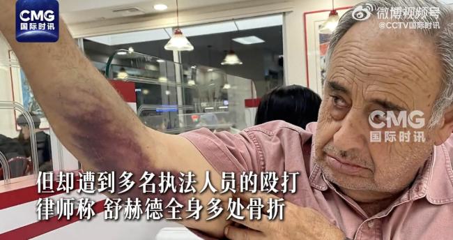 美国老人遭执法人员殴打 79岁男子起诉索赔5000万