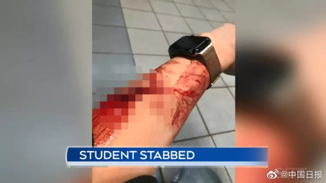 加拿大中国留学生地铁站遭持刀袭击 中领馆发提醒
