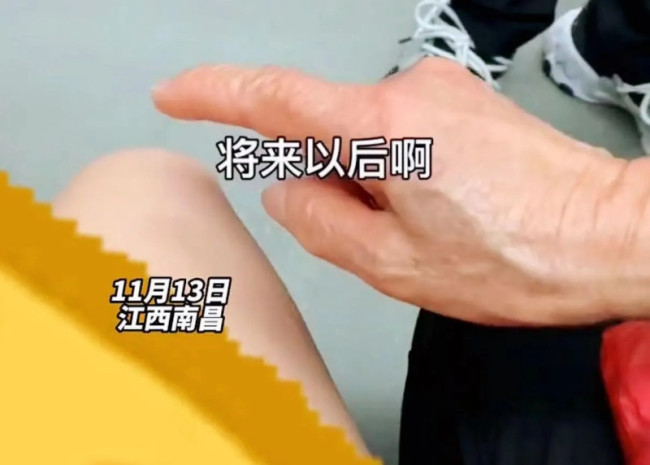 女生地铁被老人说教穿太少膝盖疼 网友：经验教训