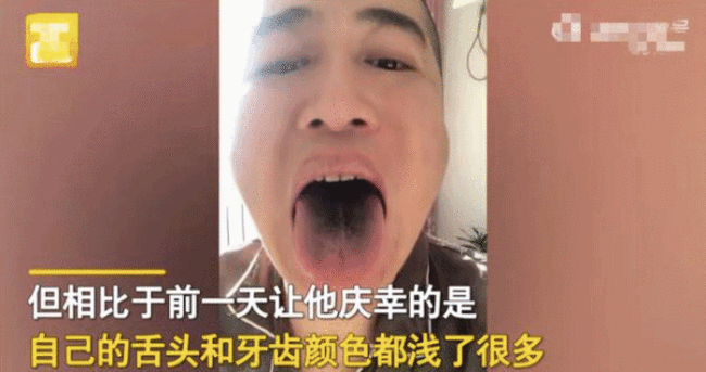 男子确诊后舌头牙齿全变黑，一查吓一跳：还有这副作用
