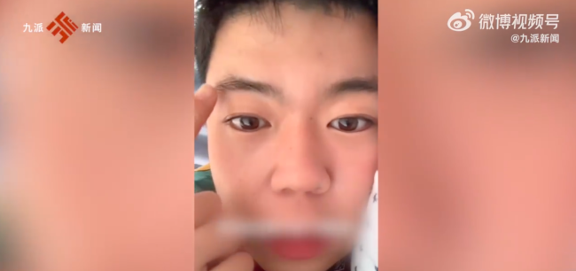 小伙阳后眉毛头发迅速增长