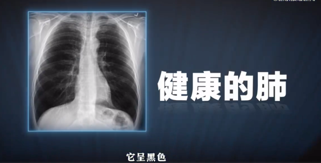 3分钟180秒拆解“白肺”六大疑问