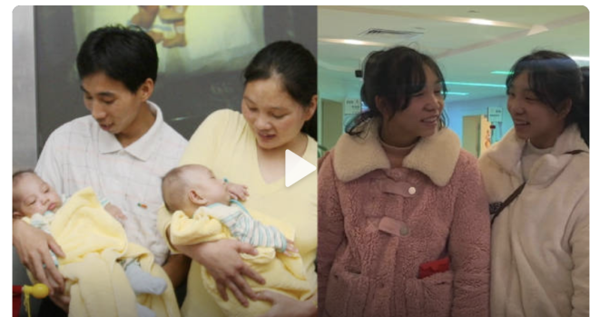 连体女婴分离14年后长成健康少女  相信奇迹！跟同龄人一样健康