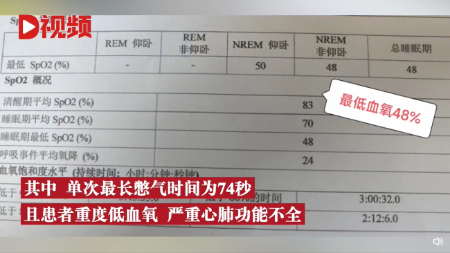 女子睡觉时呼吸暂停427次：都是肥胖惹的祸