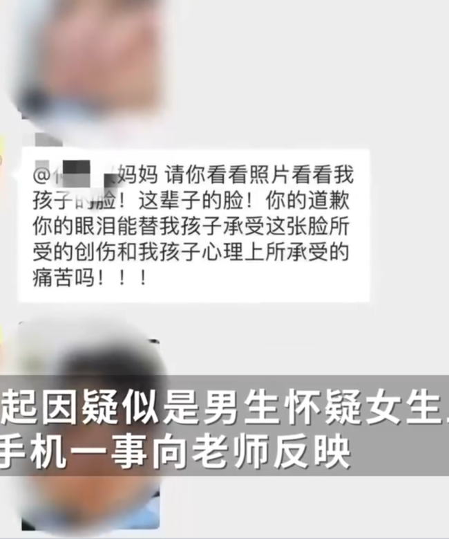 初二女生开水泼男同学脸炫耀：又不能把我怎么样，女生家长：她有抑郁症