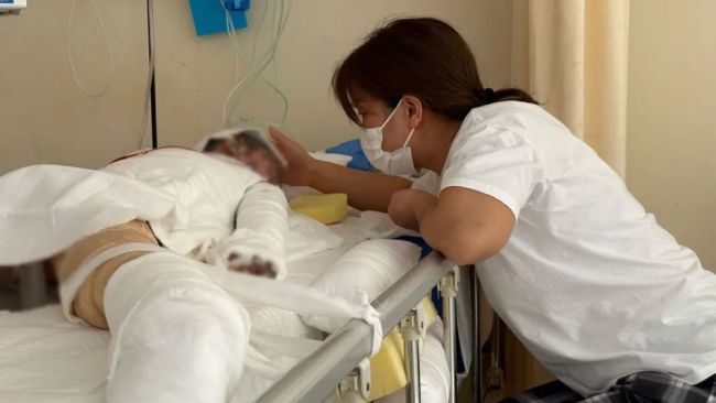 煤气燃爆致女童全身90烧伤却还关心着爸爸疼不疼